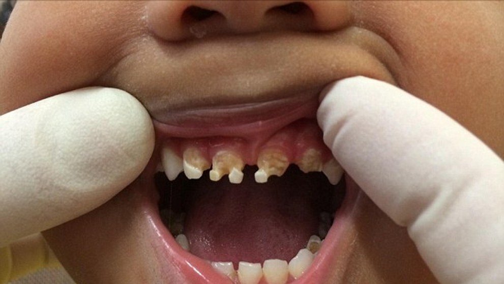 Na snímke je trojročný chlapec.