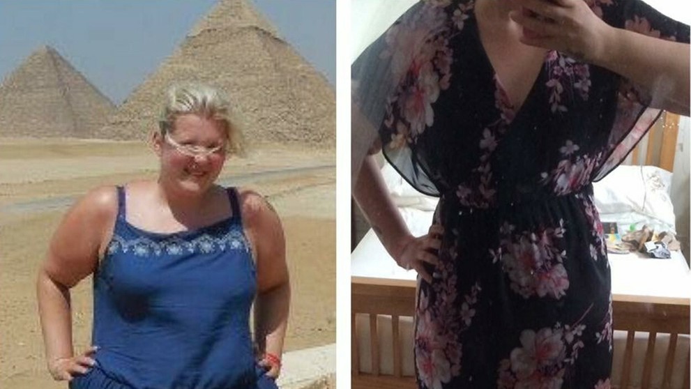 Sian Robinson predtým a teraz.