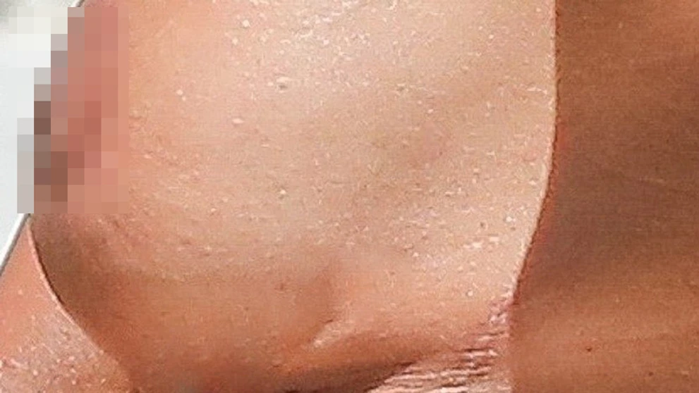 Mel B