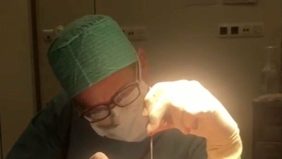 Katie Price počas chirurgického zákroku