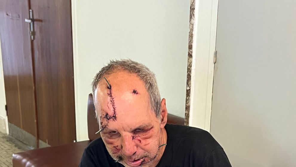 Napadnutý muž tri dni po útoku