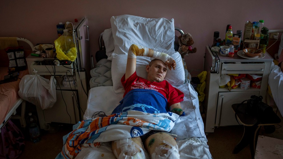 Ukrajinský zdravotník Anton Gladun, ktorý prišiel v bojoch o obidve nohy, leží na lôžku v nemocnici v meste Čerkasy.