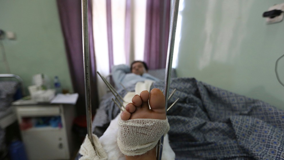 Najväčšia vojenská nemocnica v Kábule po útoku IS. 