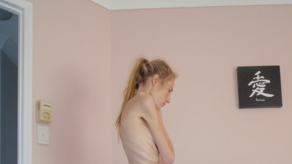 Gemma Walker ako anorektička.