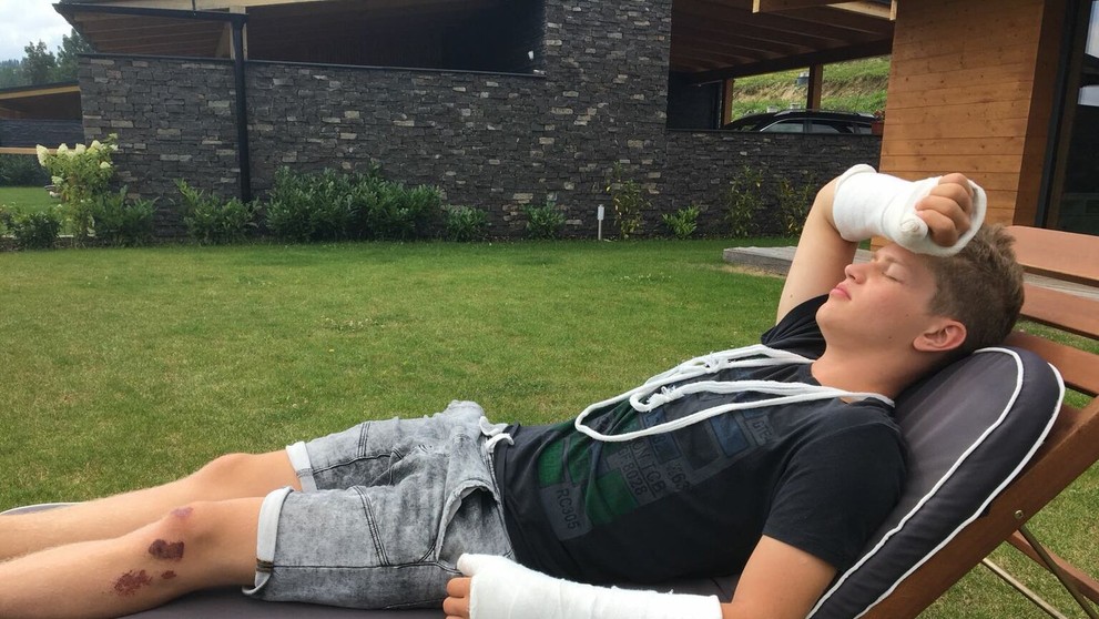 Oliver Oswald po nehode! 