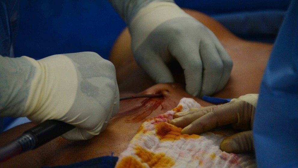 Nemecká sexbomba ukázala, ako jej vylepšovali brucho a zadok