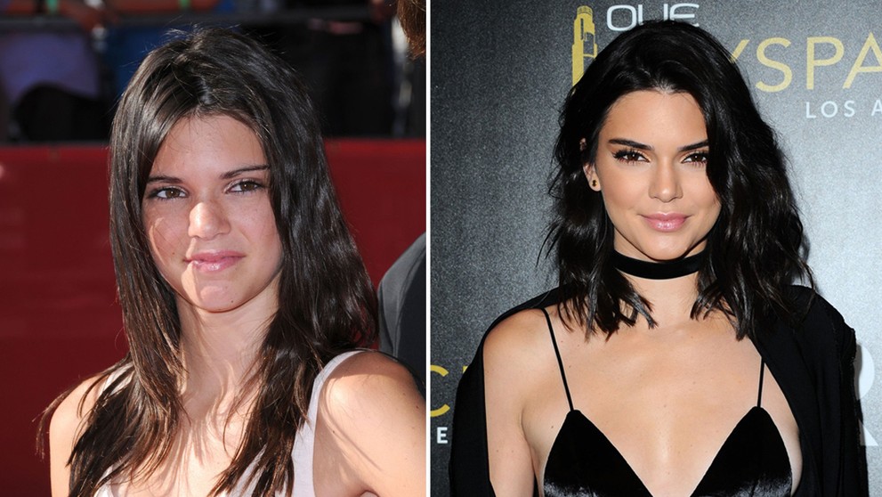 Kendall Jenner v roku 2009 a v roku 2016.