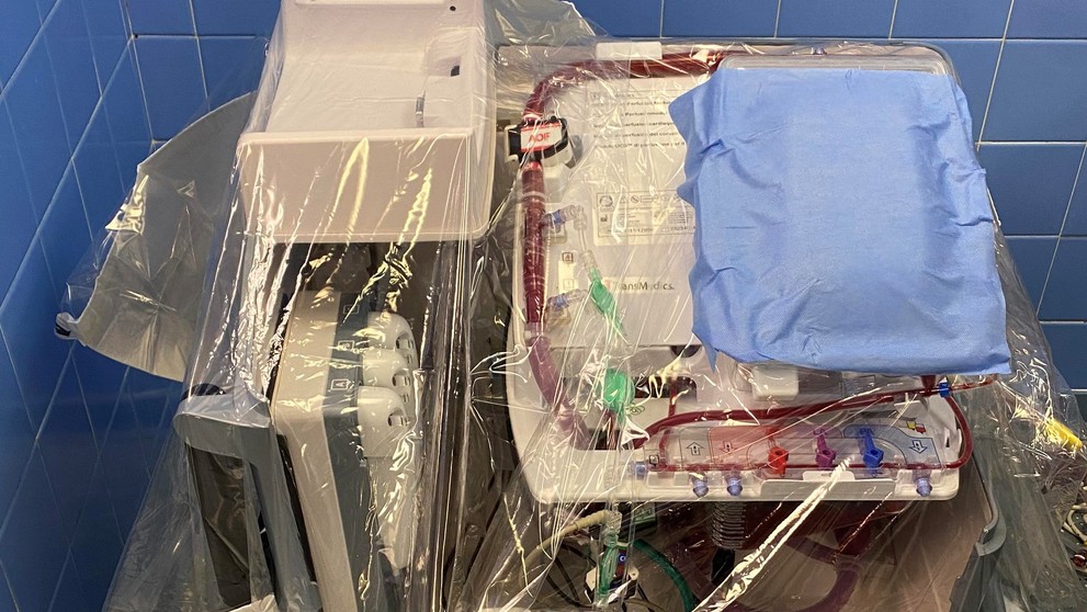 Transplantácia bijúceho srdca.