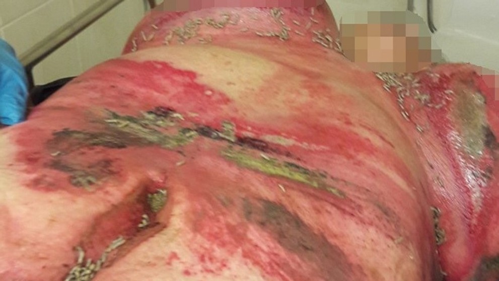 Žena sa sťažovala na bolesti.