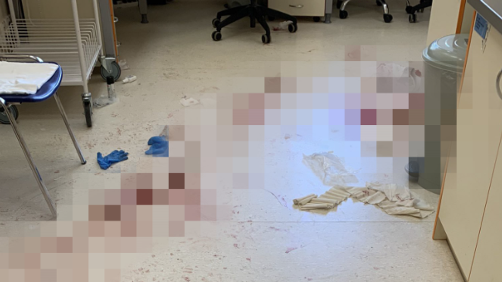 Nemocnica, v ktorej sa stal útok mačetou