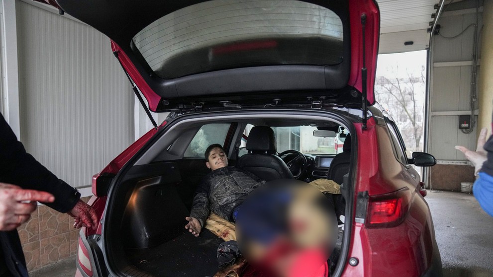 Zranený 15-ročný Arťom po ostreľovaní v Mariupole.