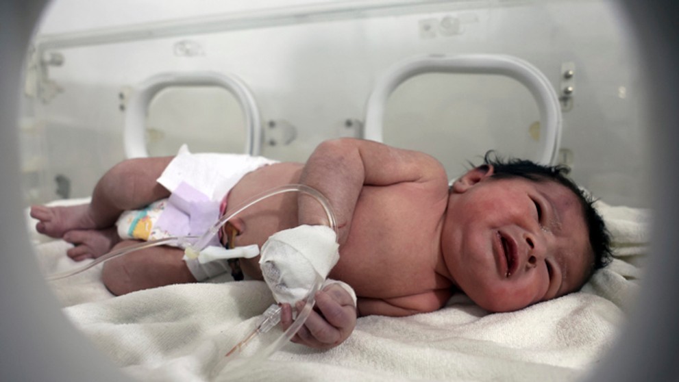 Dievčatko leží v inkubátore v detskej nemocnici v sýrskom meste Afrín.
