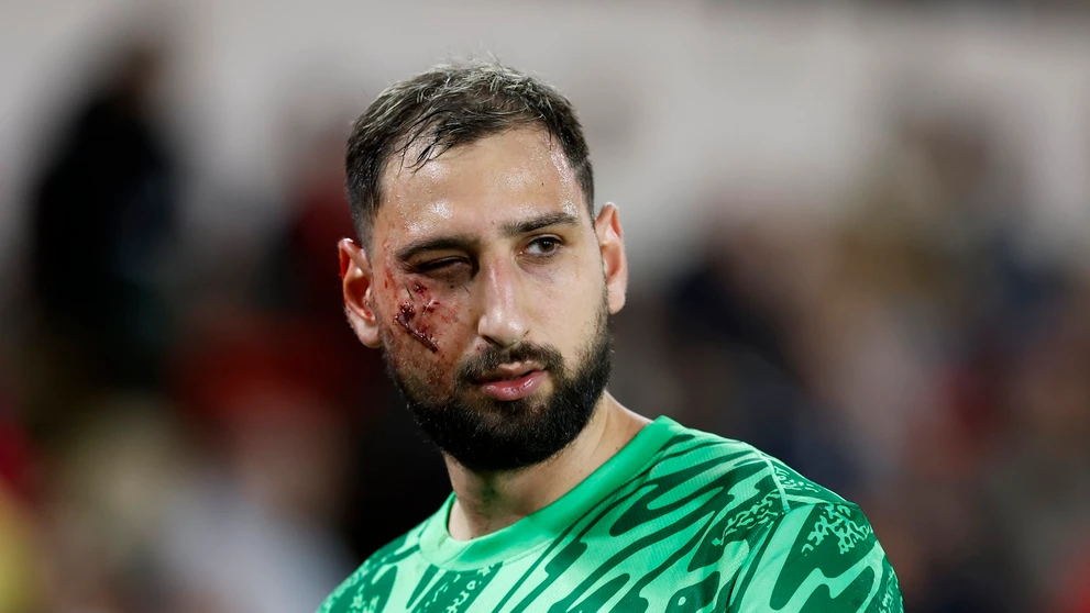 Gianluigi Donnarumma utrpel nepríjemné zranenie.