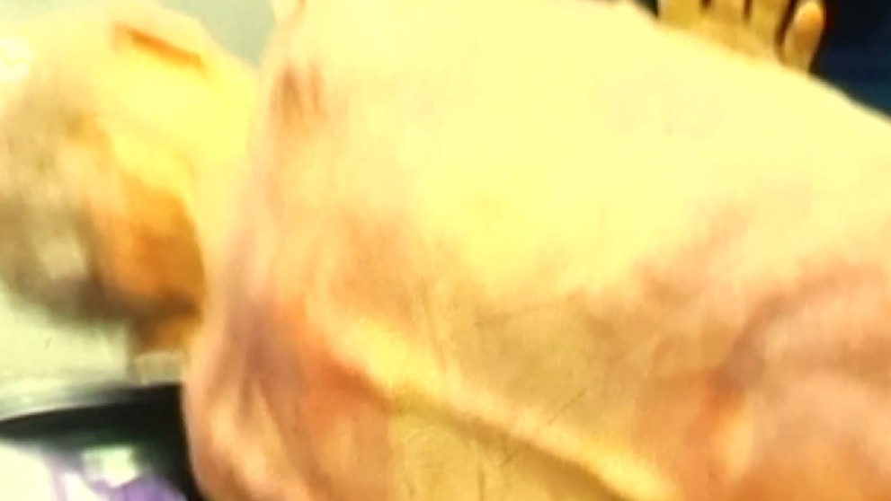 Otec pani Andrey mal preležaniny a drobné rany po tele.