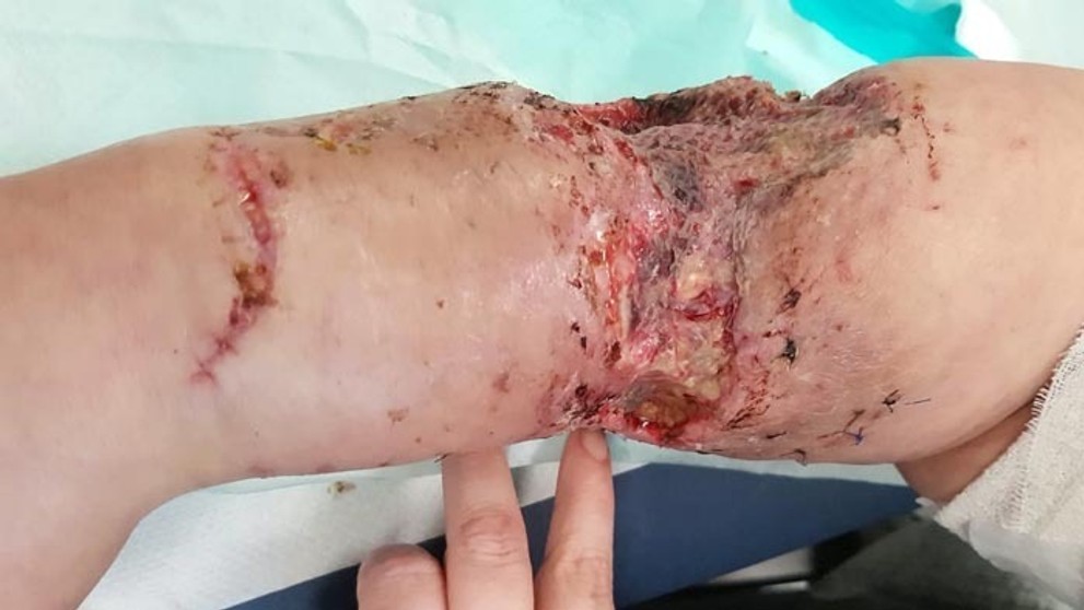 V Martine je takmer nulová viditeľnosť.