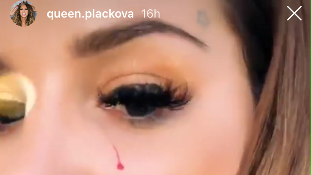 Zuzanu Plačkovú doškriabalo tigrie mláďa. 