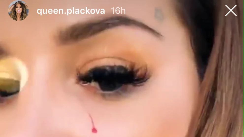 Zuzanu Plačkovú doškriabalo tigrie mláďa. 