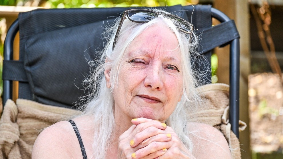 Reakcia Jean Hill na slnko.