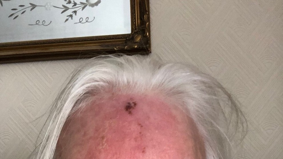 Reakcia Jean Hill na slnko.