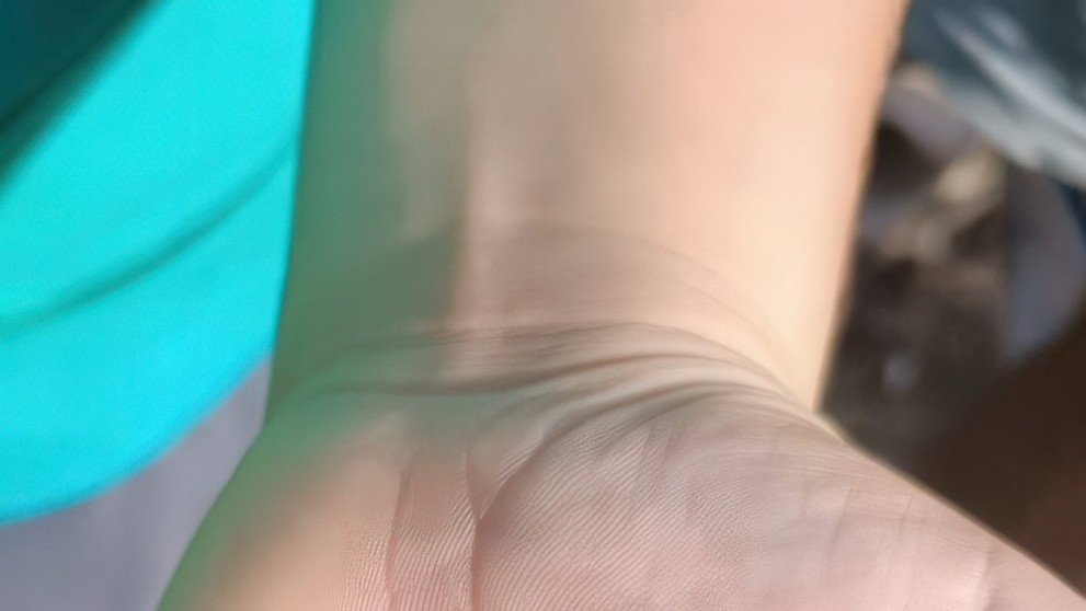 Časť jedného z vybuchnutých pagerov.