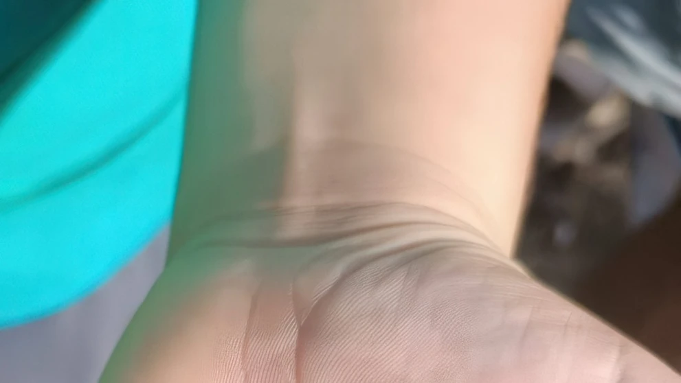 Časť jedného z vybuchnutých pagerov.