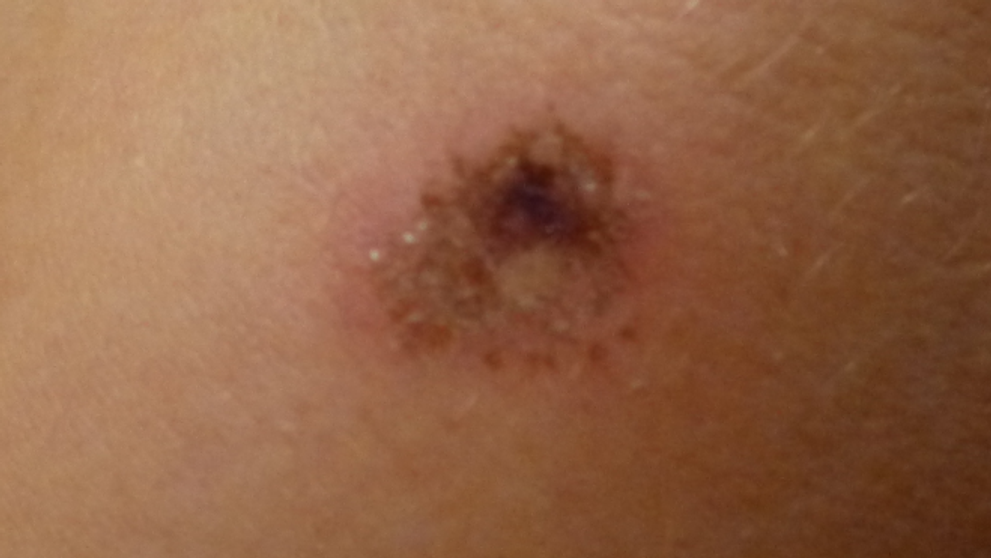 Policajná brutalita