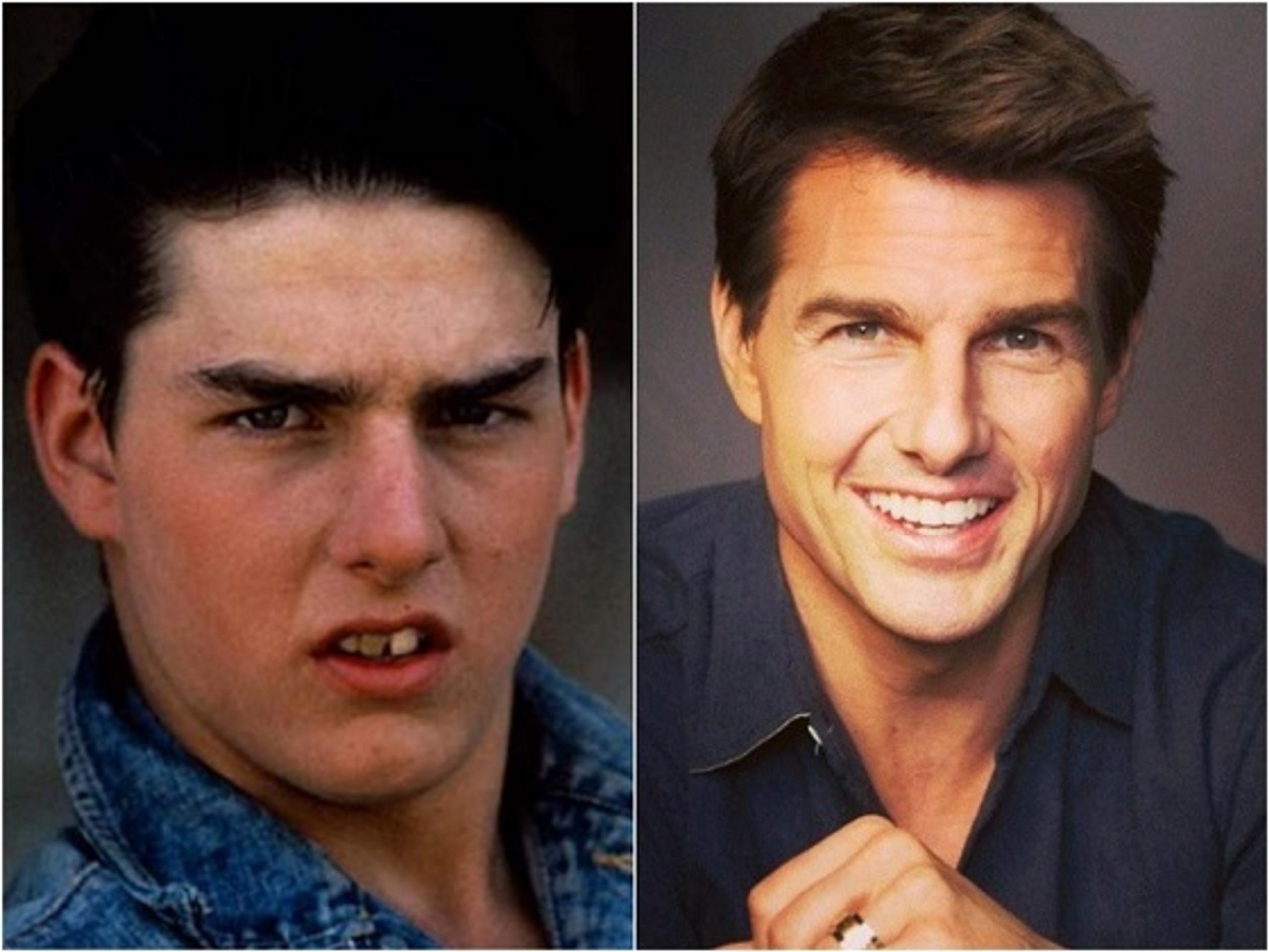 Tom Cruise