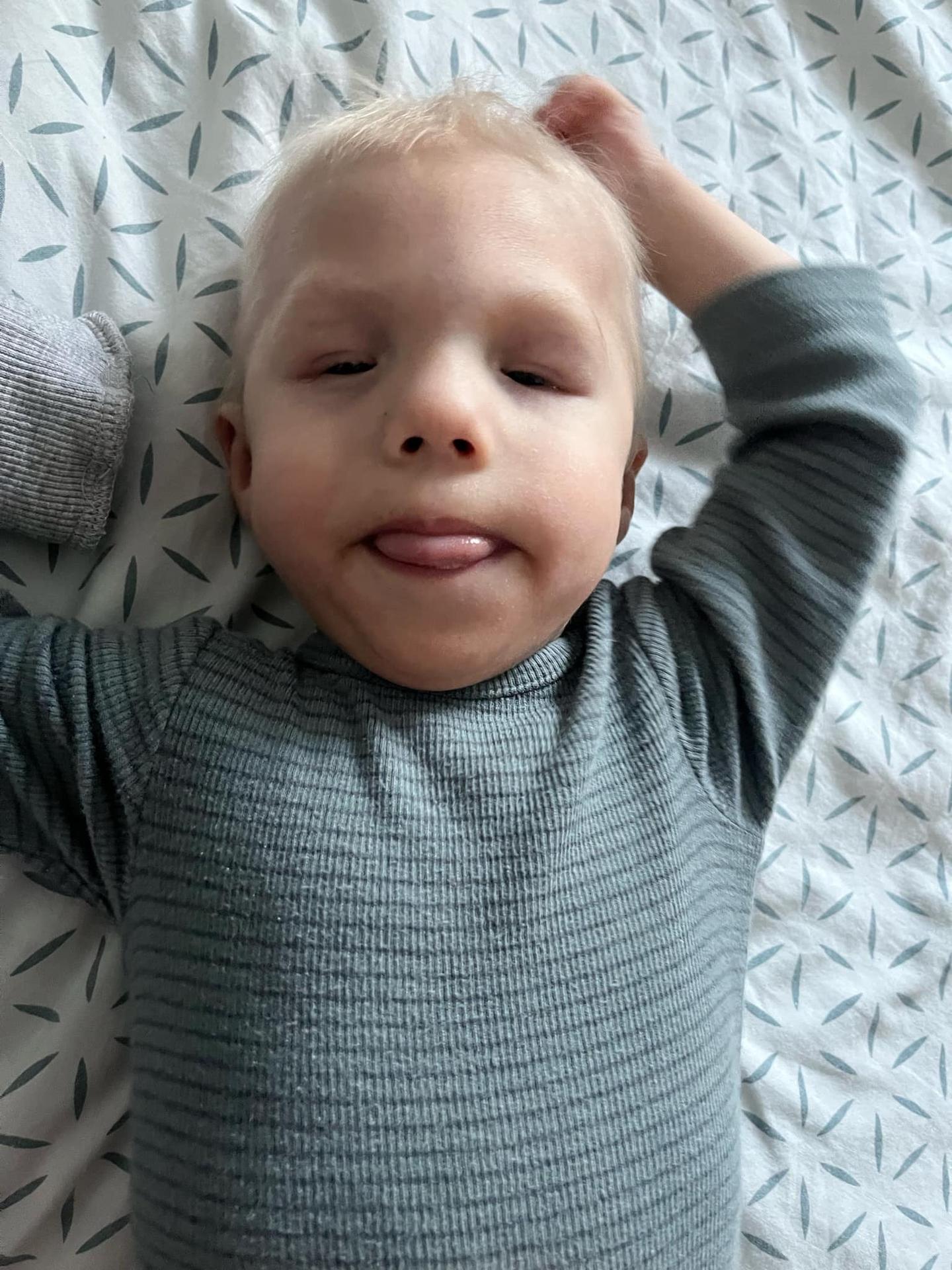 Timiho diagnóza nie je známa