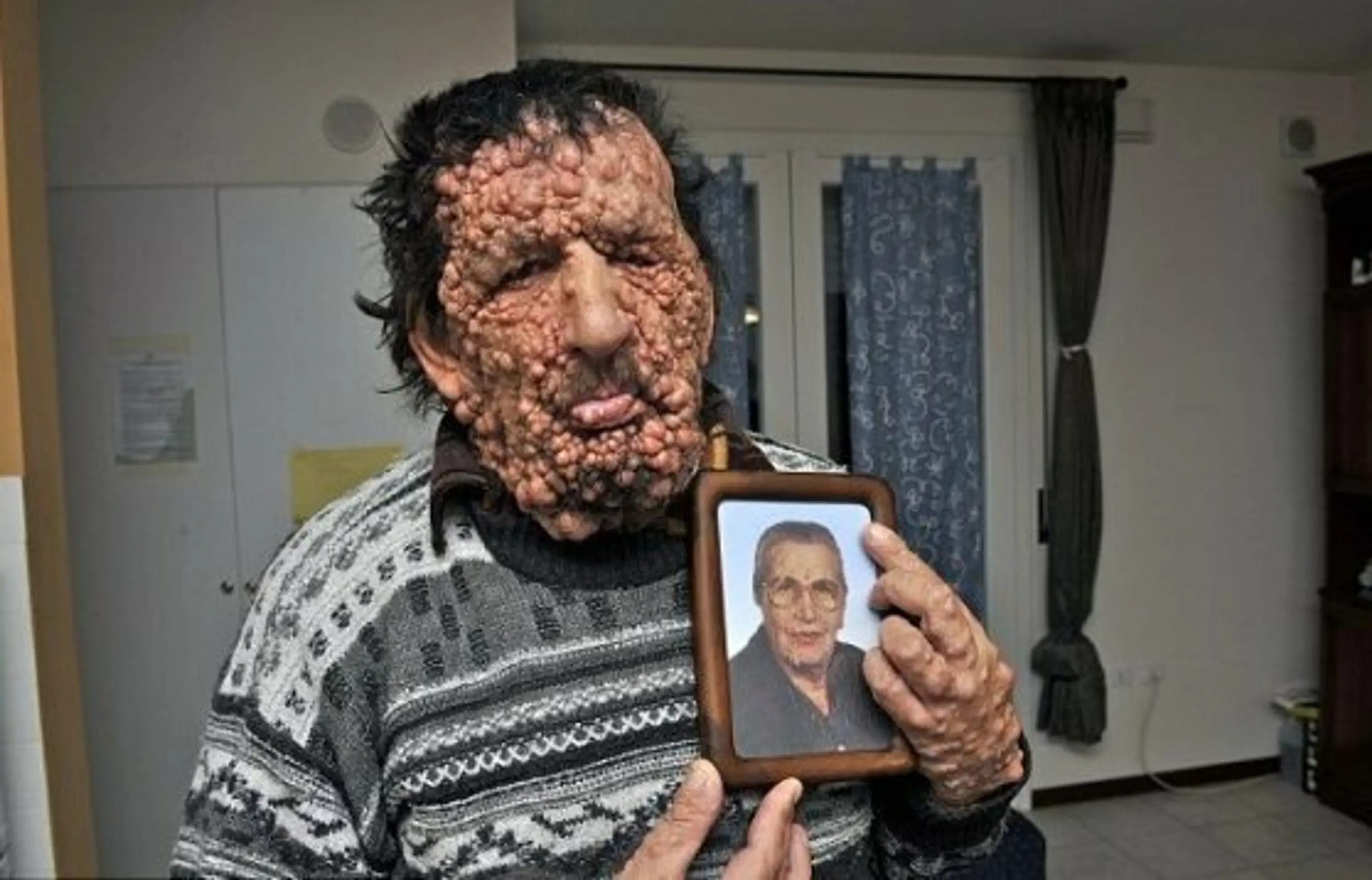 Sloní muž