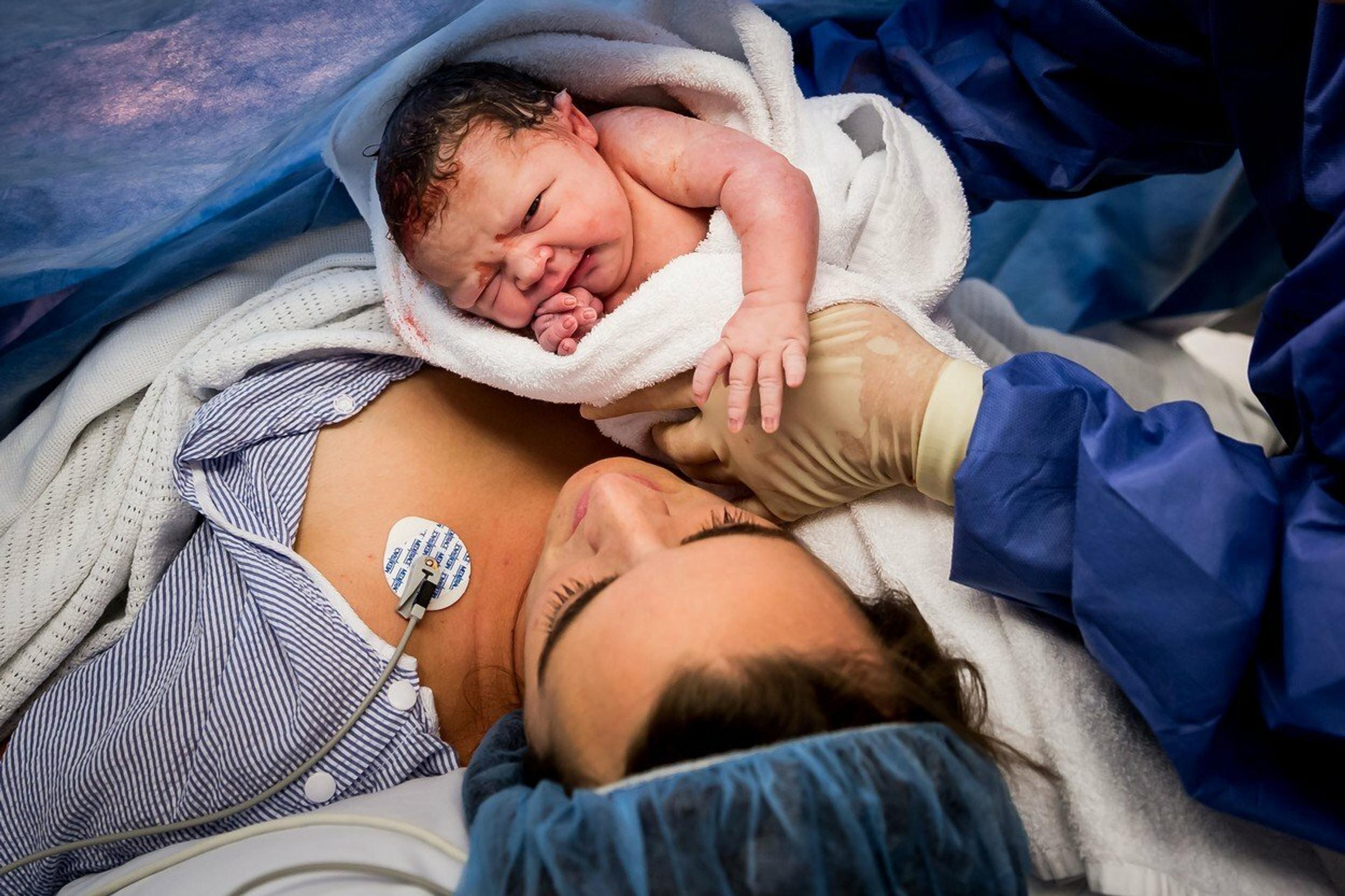 Špeciálne puto medzi mamičkou Stephanie a dcérkou Oliviou vzniklo pár minút po jej príchode na svet.