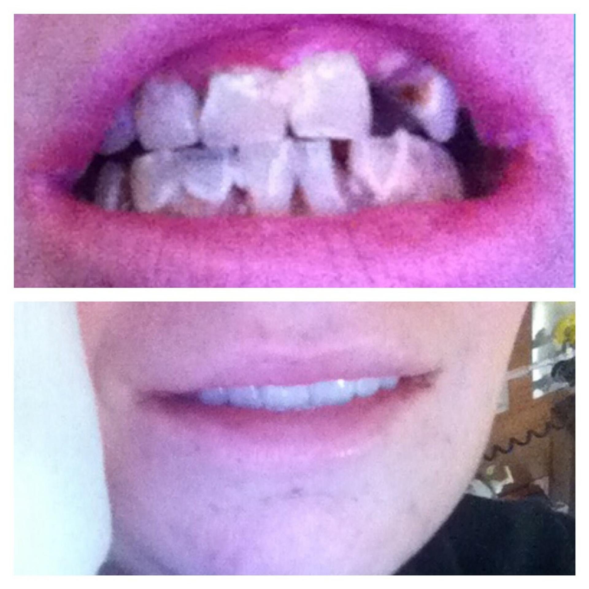 Skye Simpsons prišla o zuby.