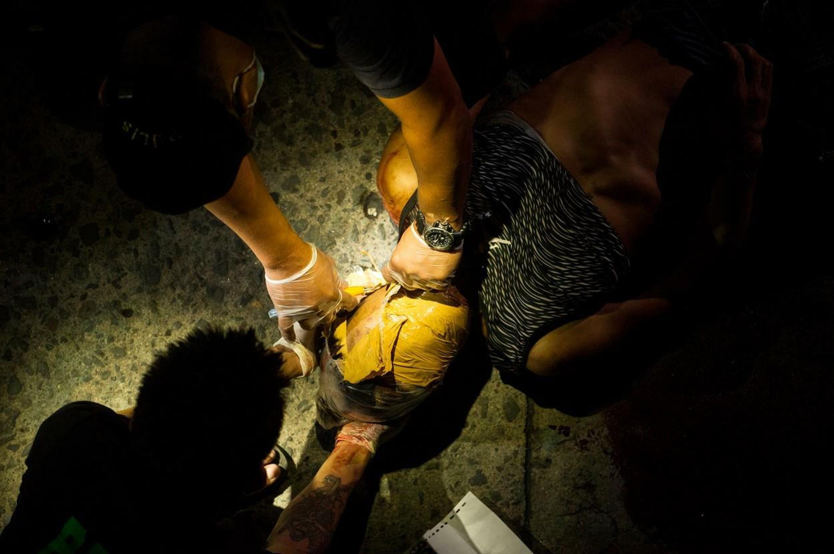 Znetvorená mŕtvola oblepená páskou