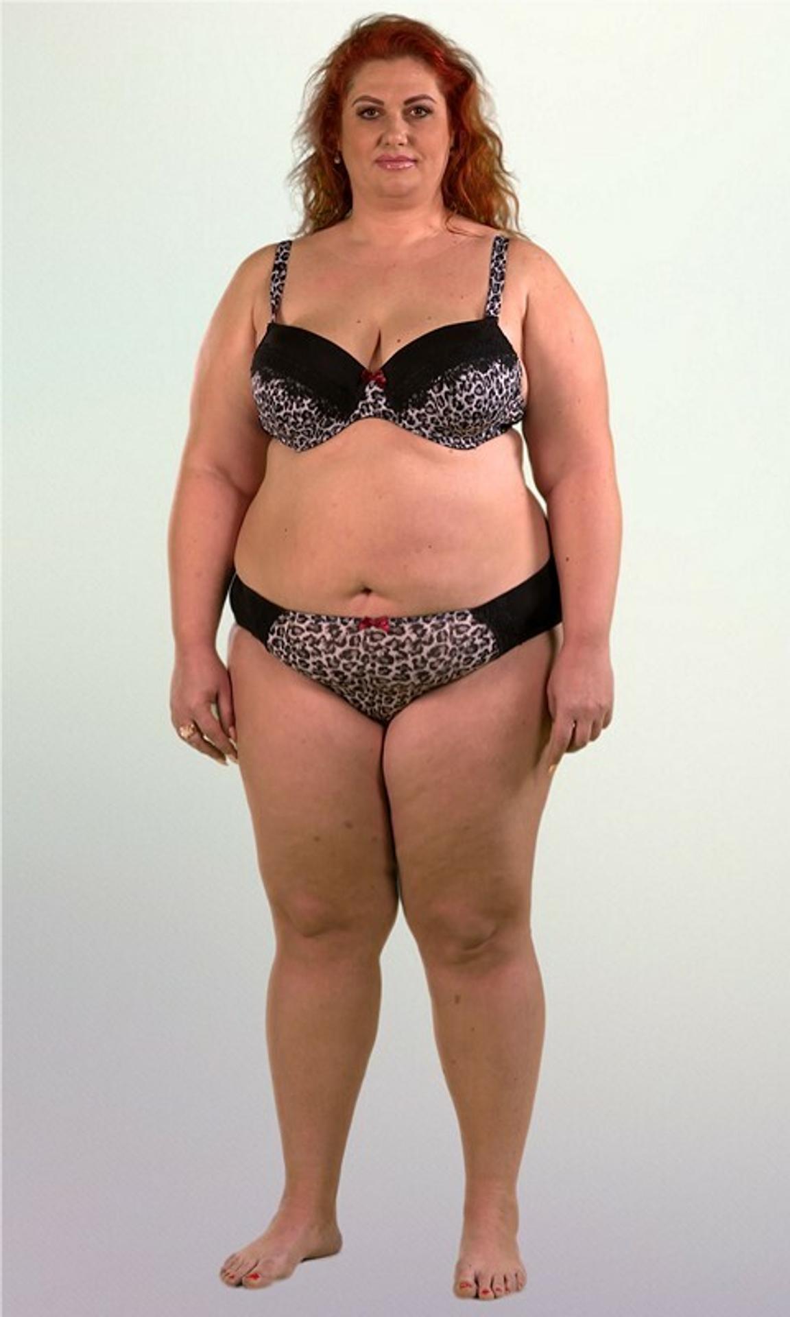 Najmladšia víťazka Euromiliónov minula peniaze na plastiky. Takto vyzerá teraz