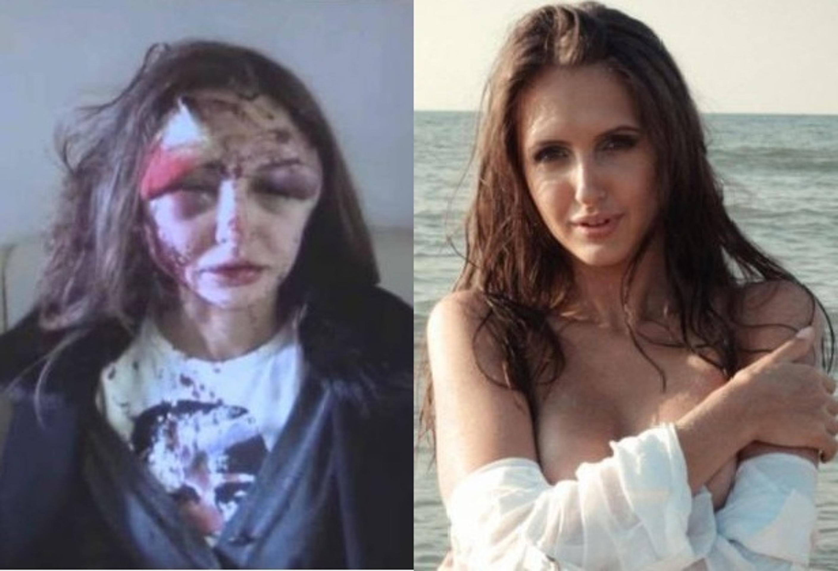 Modelka Alexandra Sereda po útoku a pred
