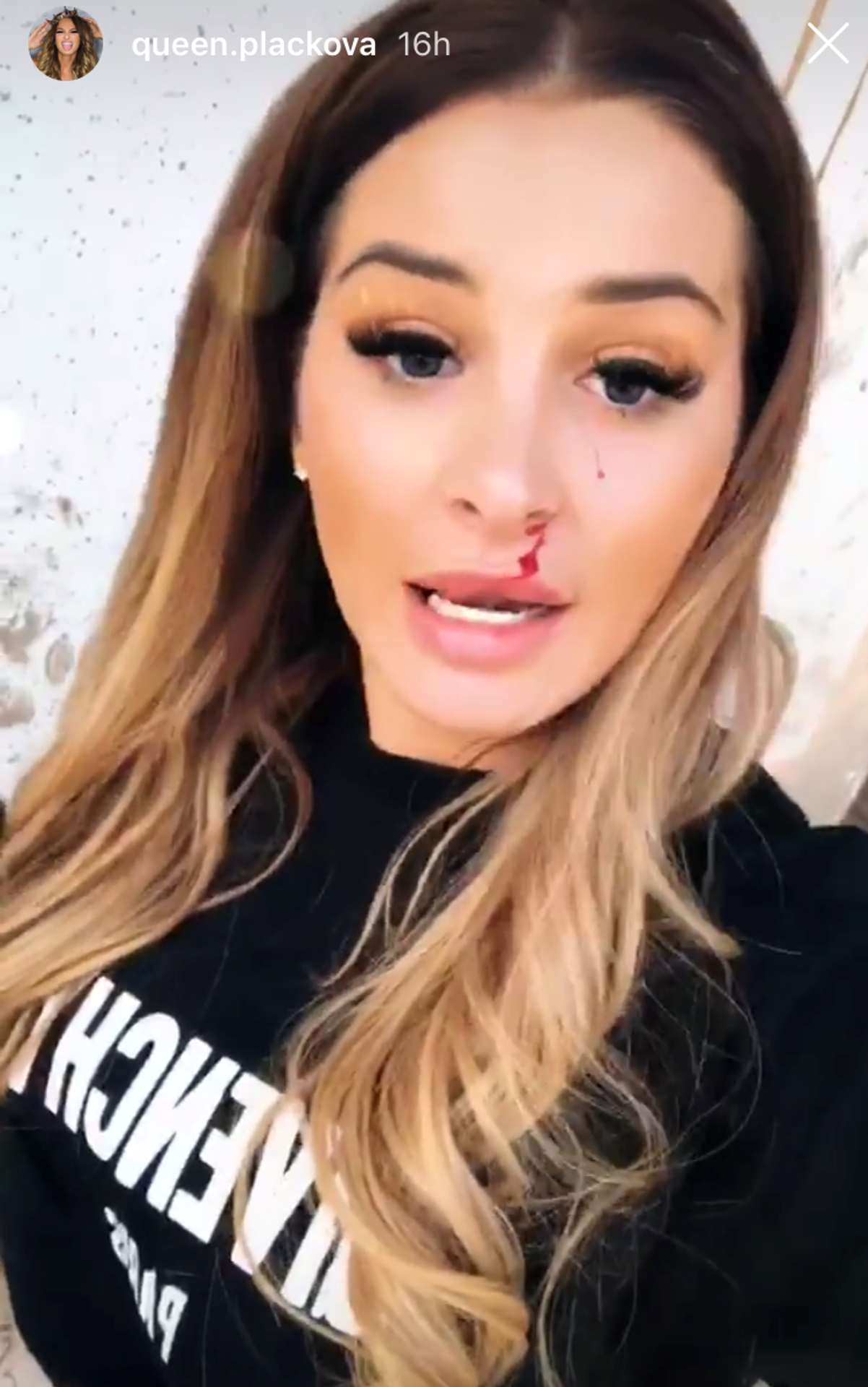 Zuzanu Plačkovú doškriabalo tigrie mláďa. 