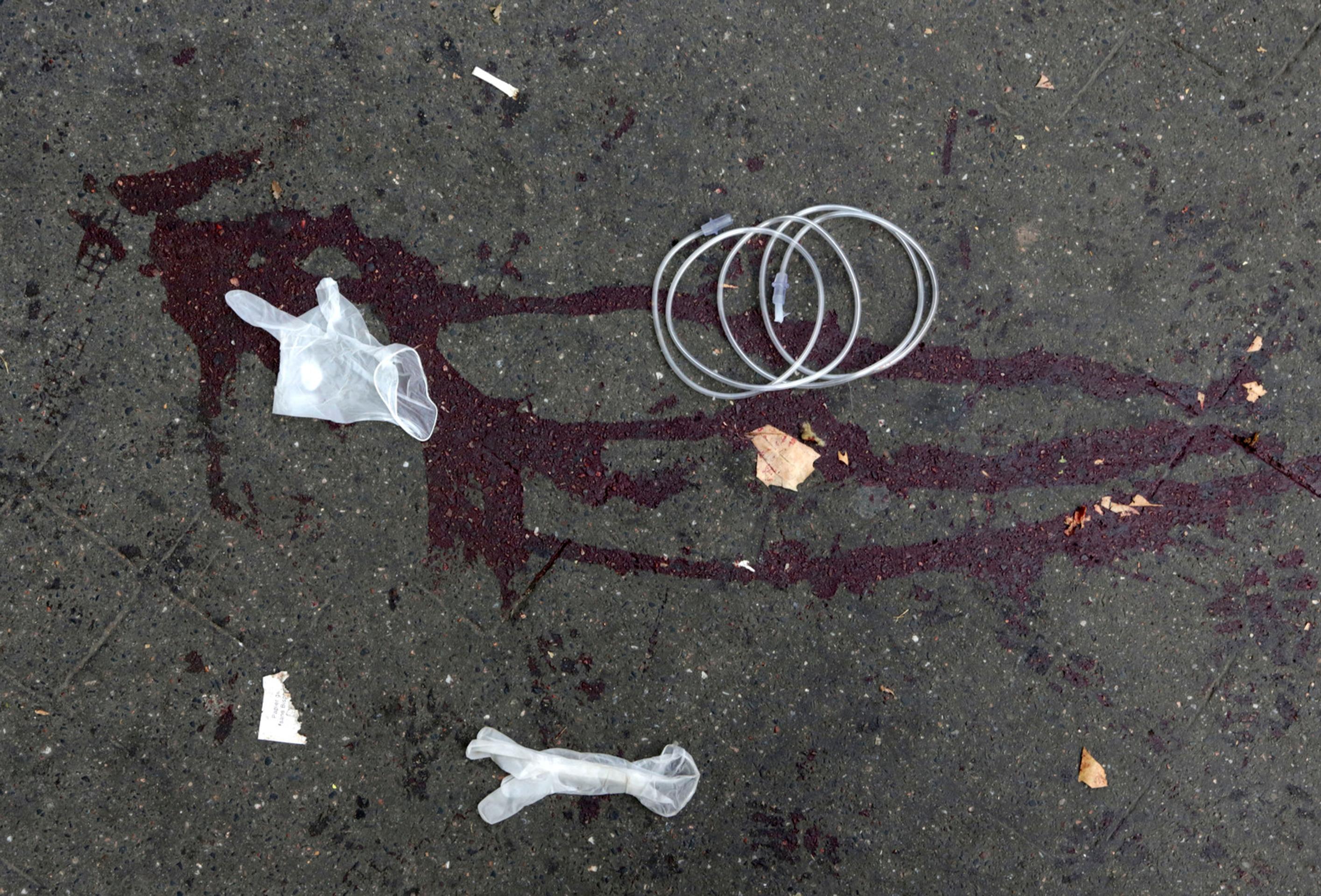 Stopy krvi pred koncertnou sieňou Bataclan v Paríži