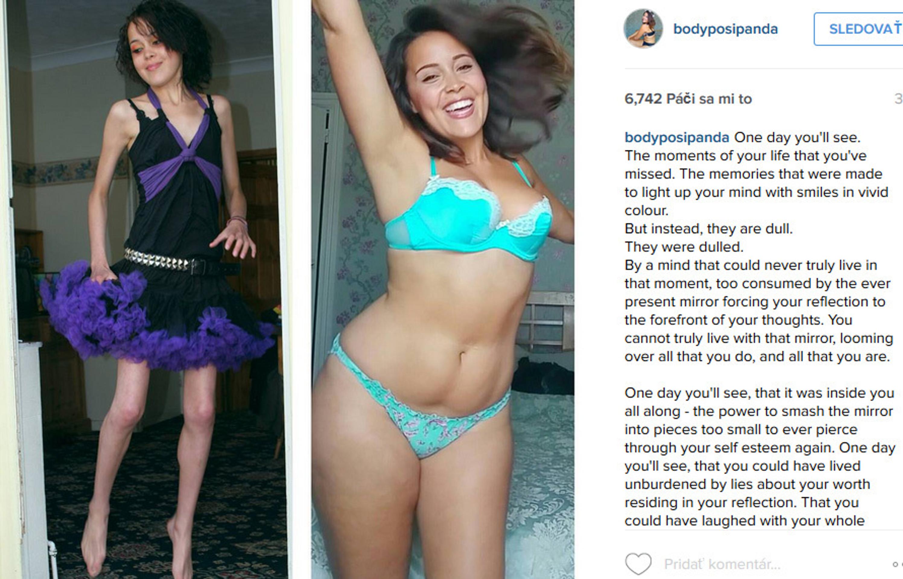 Megan Jayne predtým a teraz.