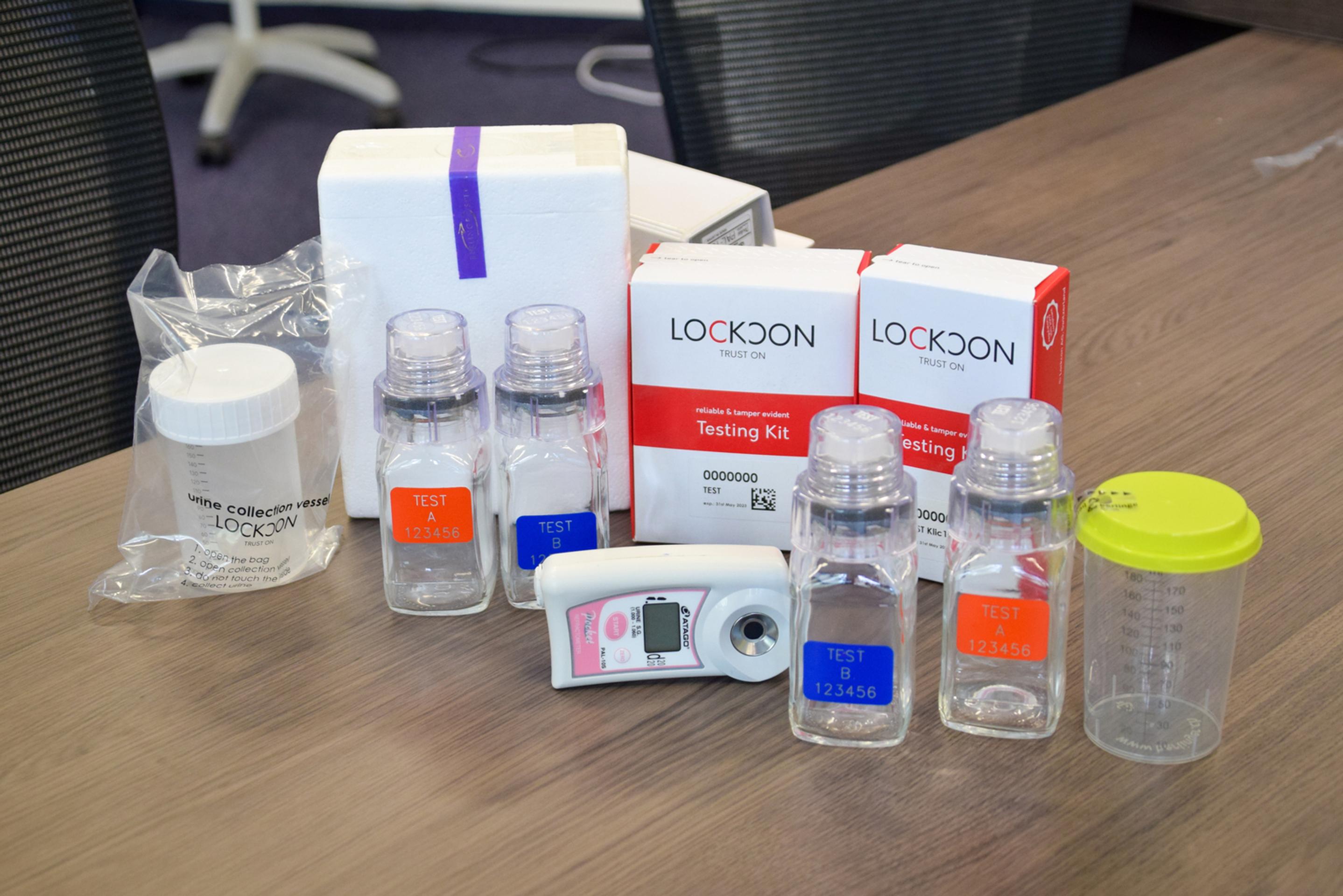 Pohárik na odober moču, ktorého vzorka sa zapečatí aj do sklenených fľašiek. Vzorky smerujú na analýzu a odkadajú sa aj na dobu 