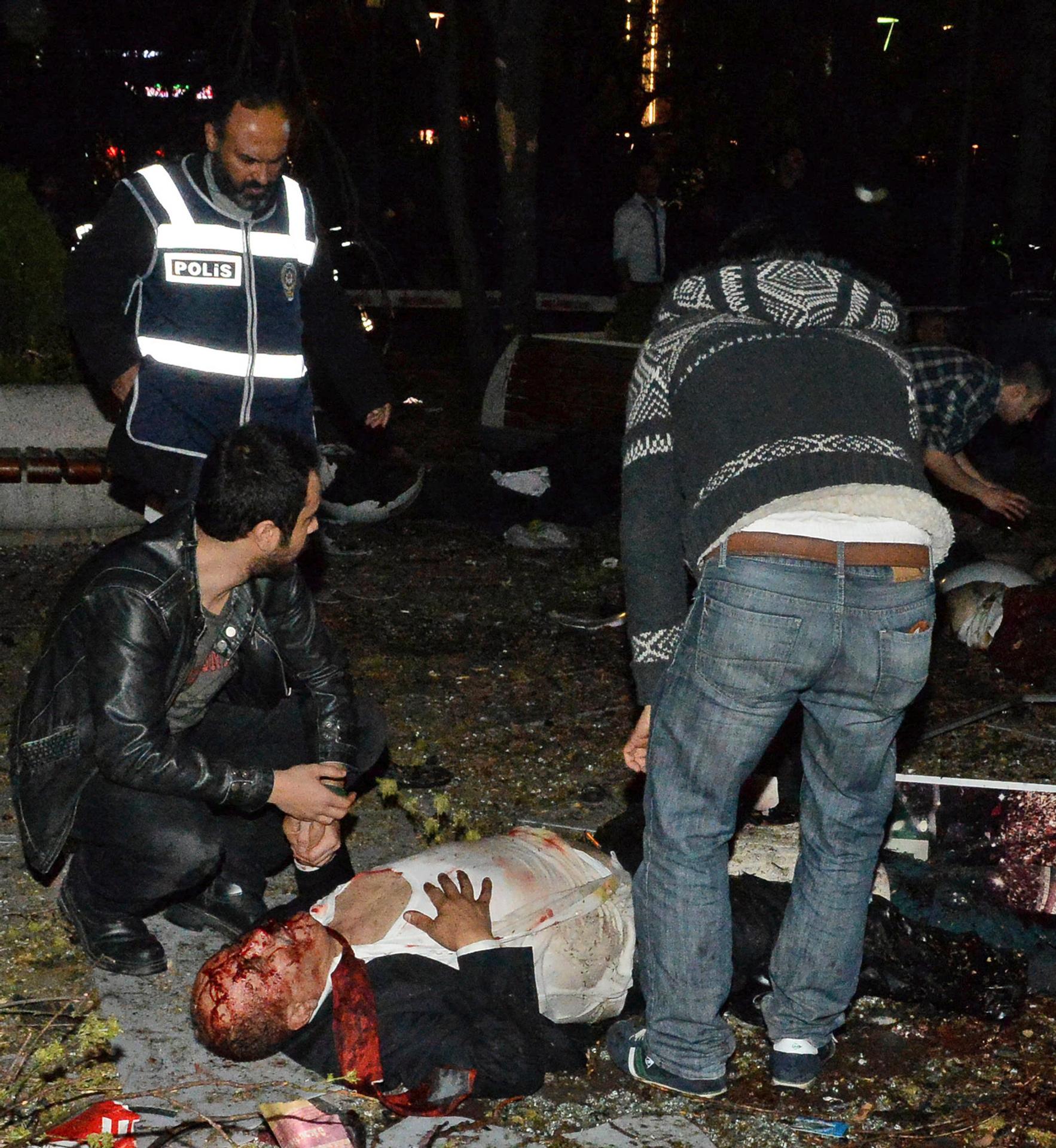 Výbuch v Ankare neprežilo 37 ľudí.