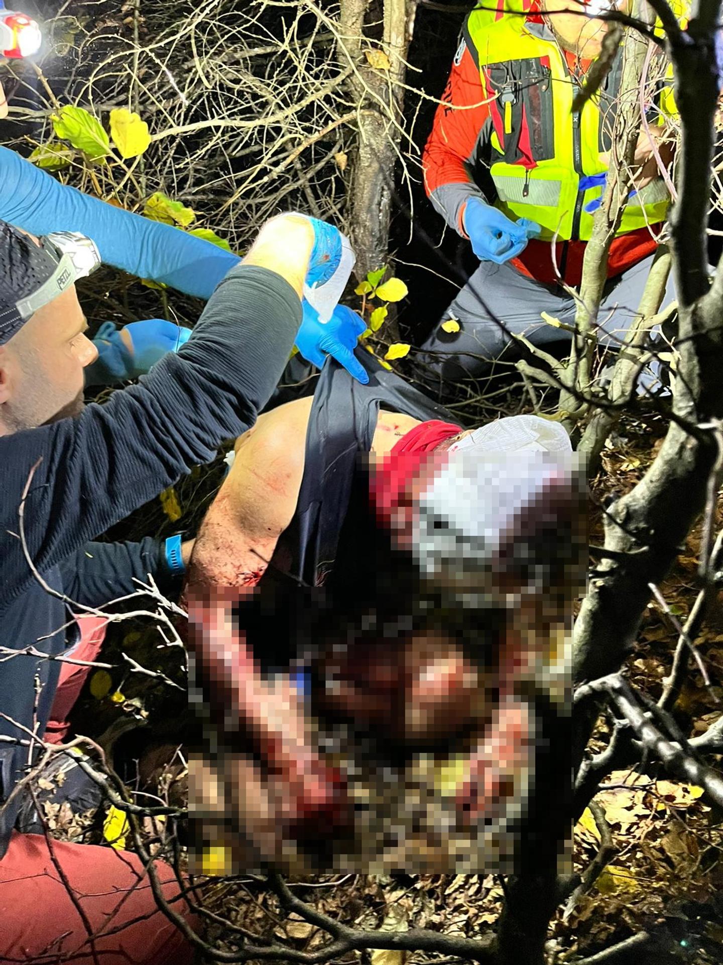 Medveď napadol bežca v Malej Fatre.