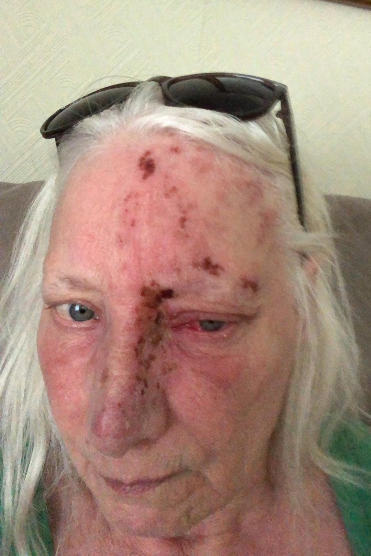 Reakcia Jean Hill na slnko.