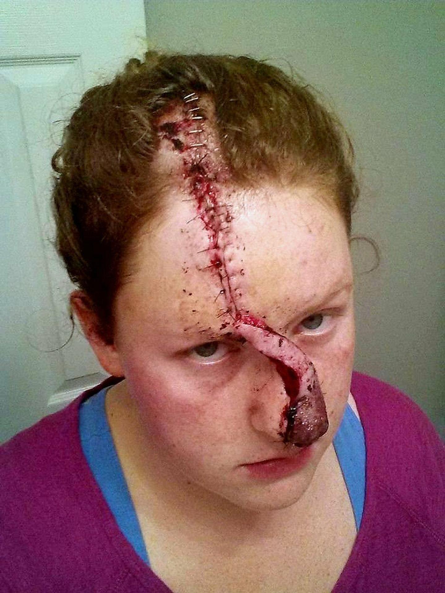 Marisha po operácii