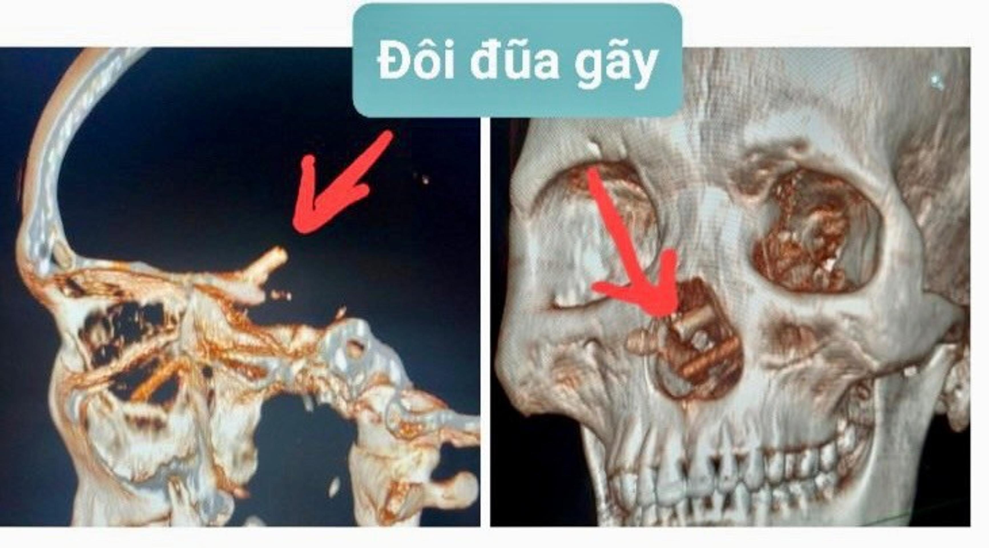 Snímka z počítačového tomografu.