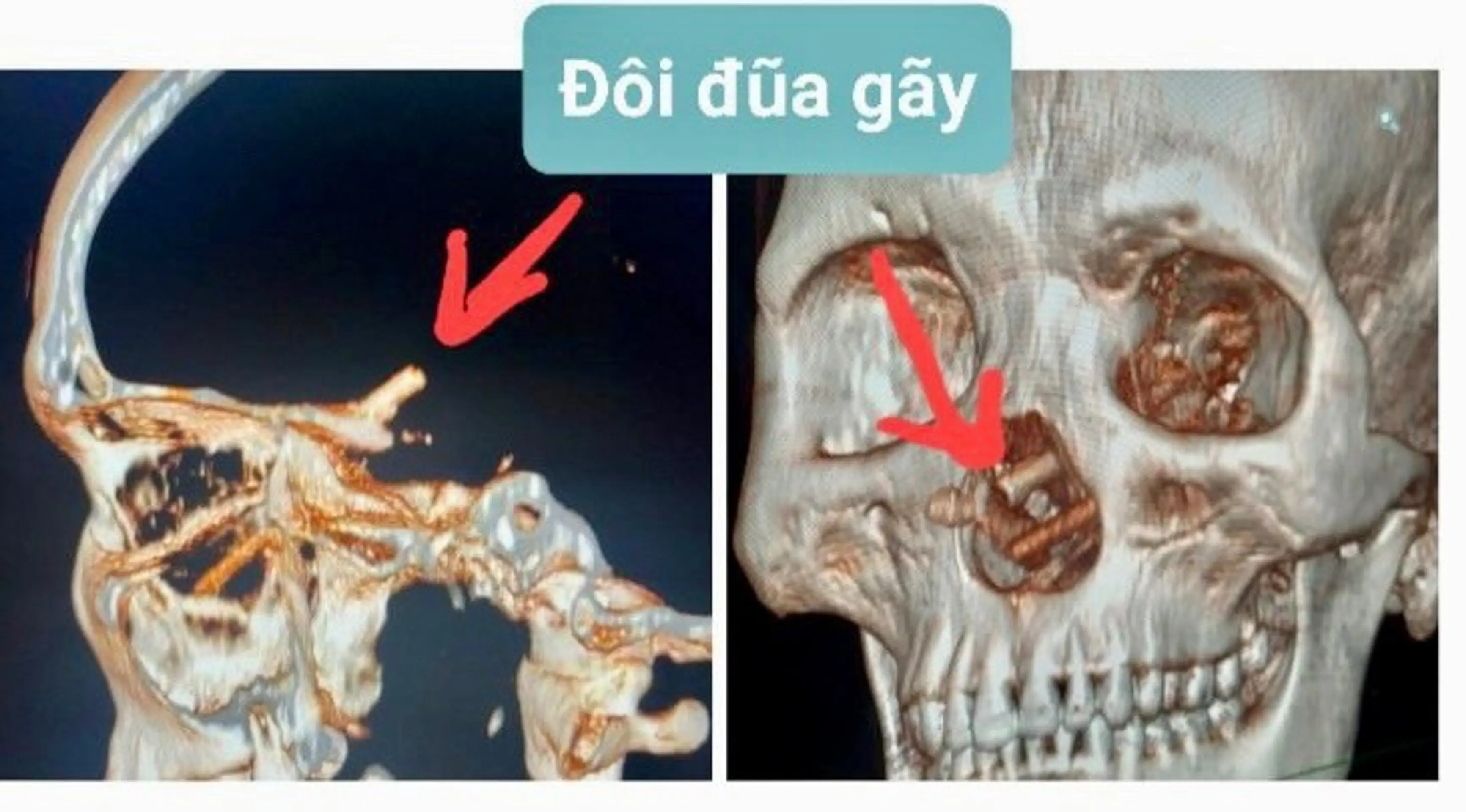 Snímka z počítačového tomografu.