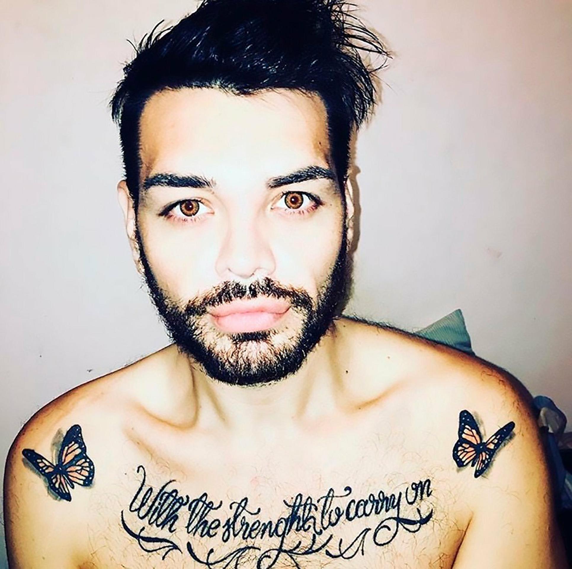 Fran Mariano si nechal napichať pery