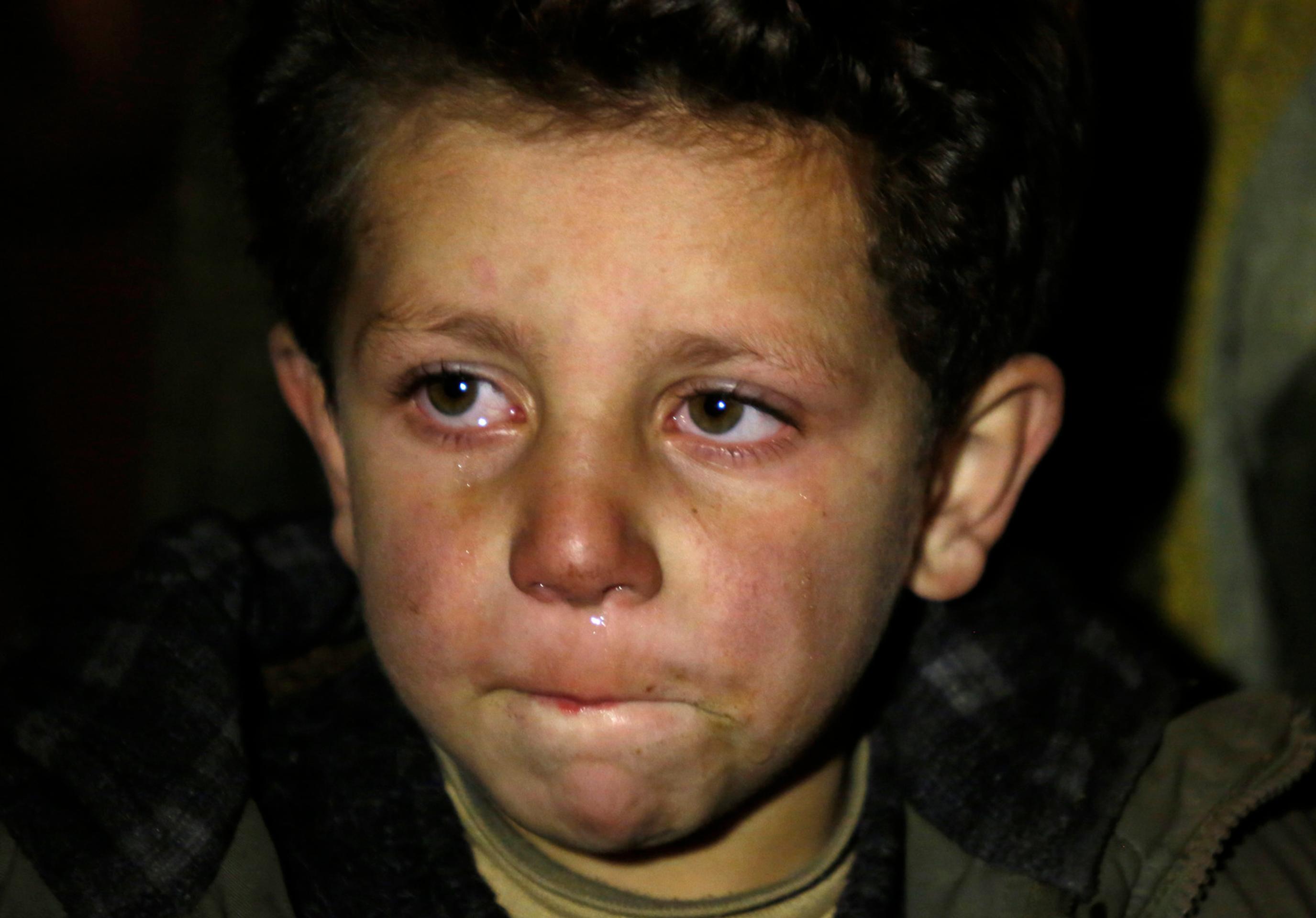 Malý chlapec zo sýrskeho mesta Madájá čaká na evakuáciu.