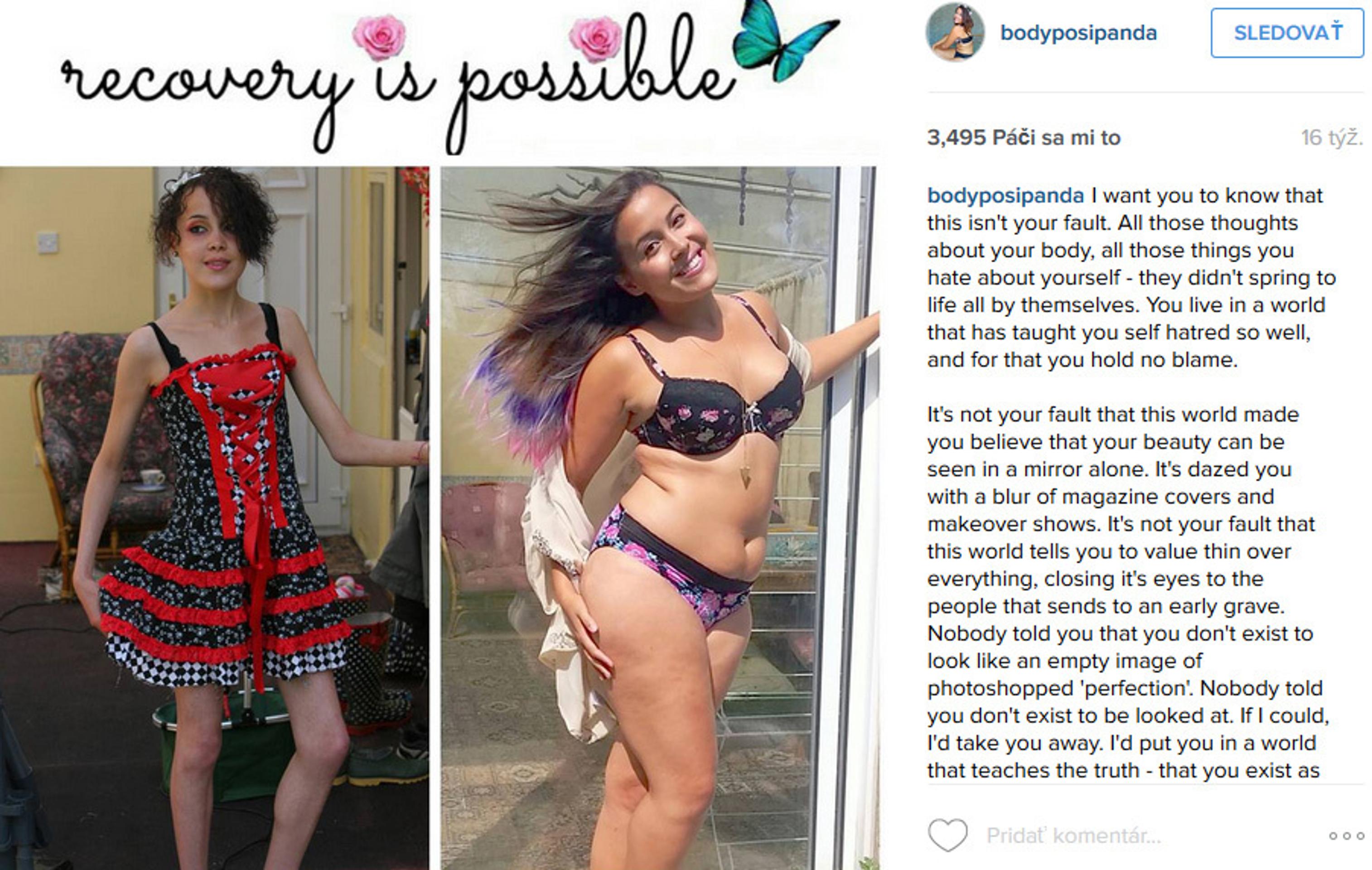 Megan Jayne predtým a teraz.