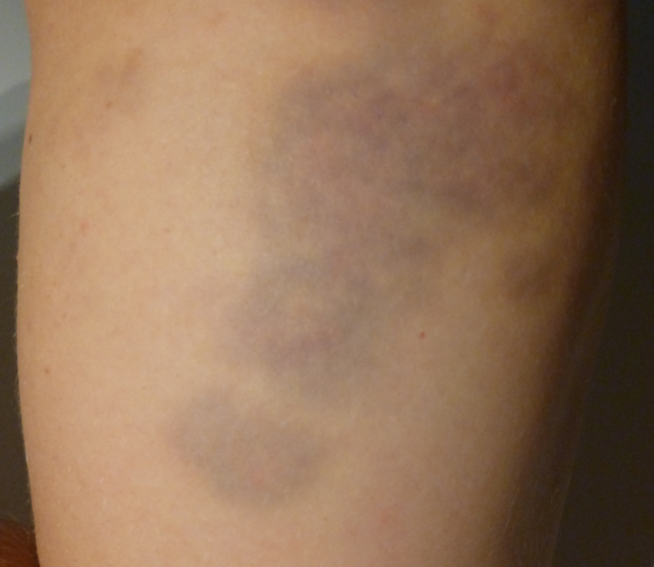 Policajná brutalita