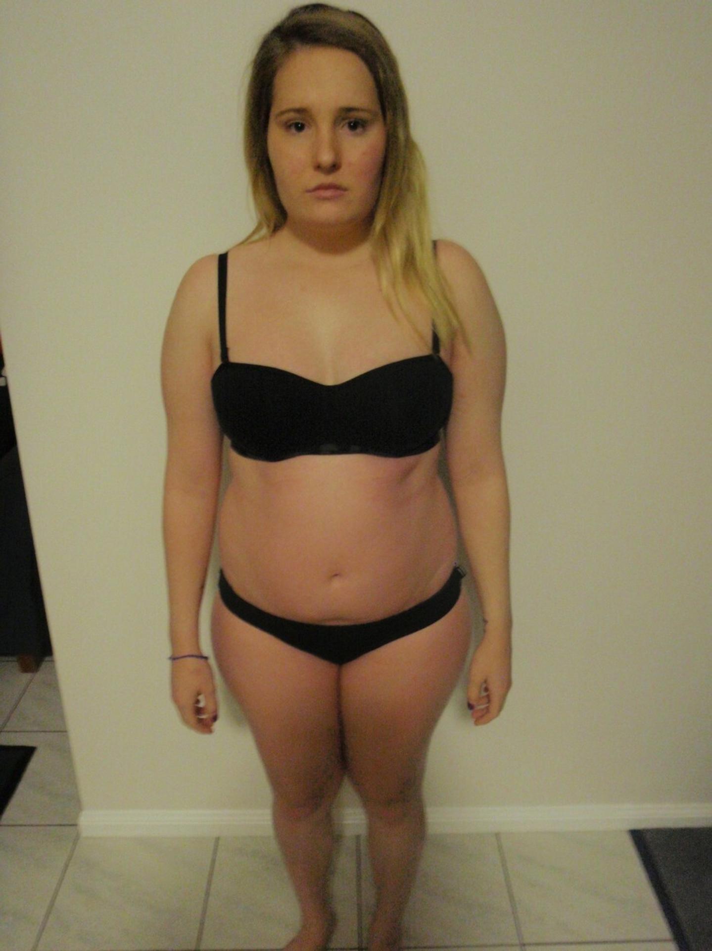 Gemma Walker pred anorexiou.