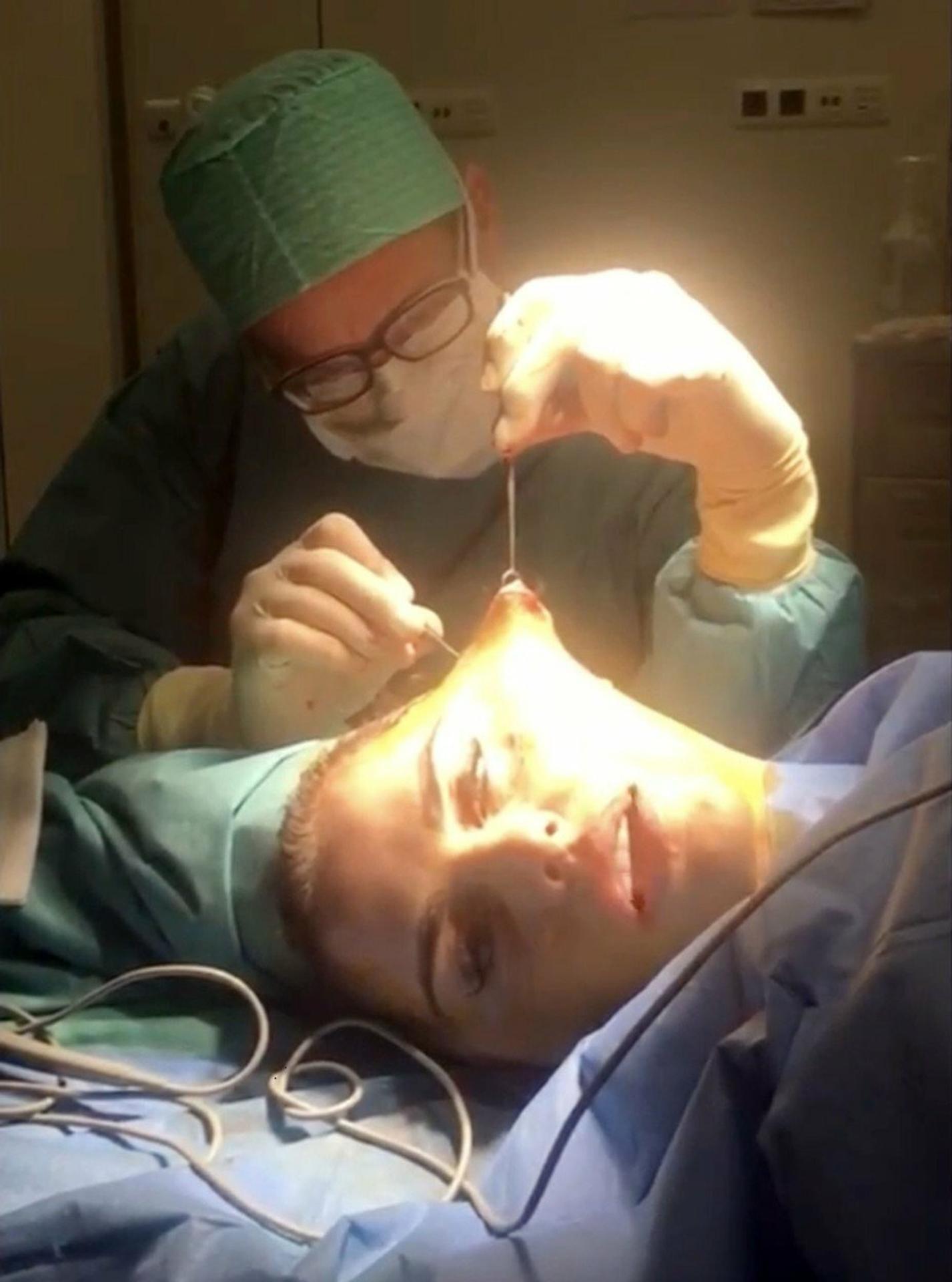 Katie Price počas chirurgického zákroku